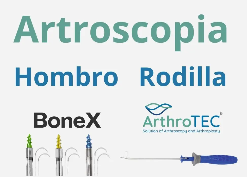 Implantes de artroscopia para rodilla y hombro
